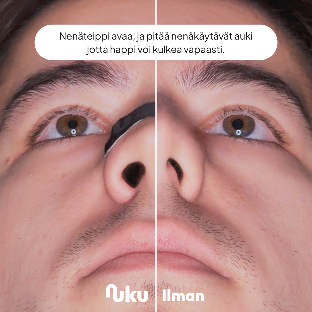 Urheilunenäteippi
